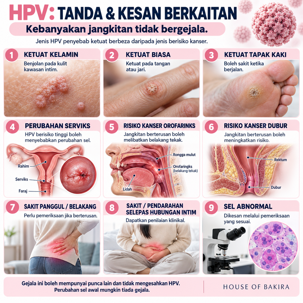 Infografik sembilan tanda dan kesan berkaitan HPV. Ketuat kulit berbeza daripada jenis berisiko kanser. Gejala tidak mengesahkan HPV; pemeriksaan klinikal diperlukan.